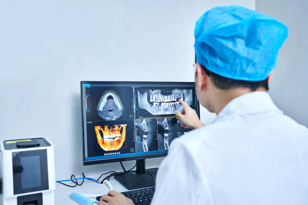Best Emergency Tooth Extraction in Lecanto, FL